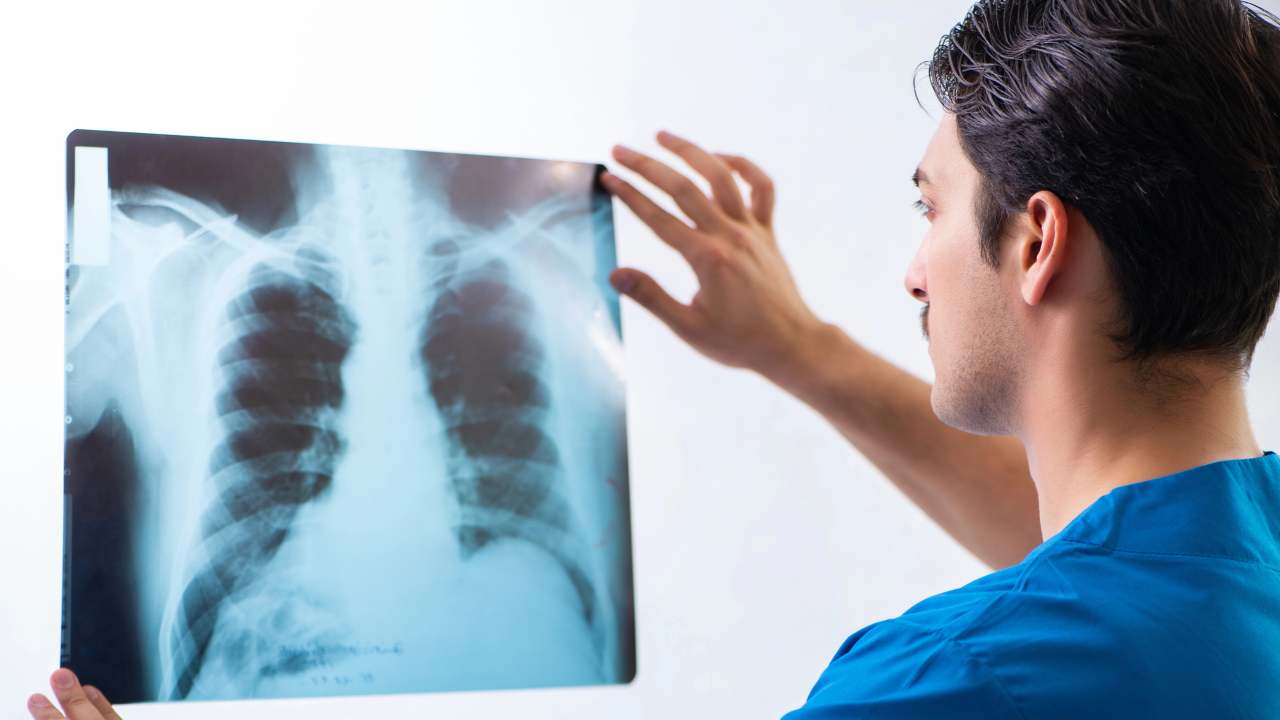 Cancro polmonare (depositphotos) - ilcorrierino.com